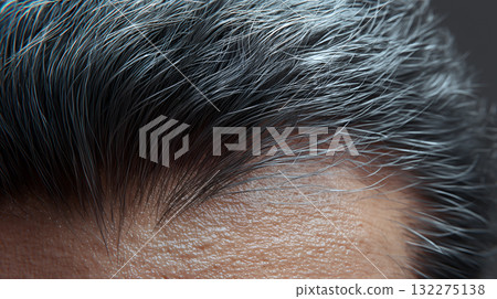 Close-Up of Graying Hair and Visible Scalp with Skin Texture and Pores 132275138
