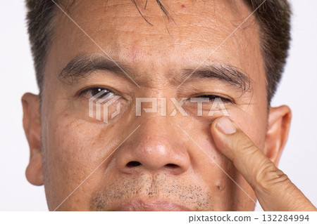 Senior man eye strain after for long stretches at digital screens. 132284994