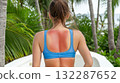 Young caucasian female with sunburned back in tropical paradise: sun safety awareness 132287652