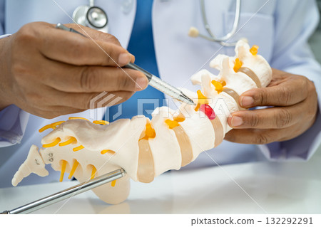 Doctor with lumbar vertebra bone skeleton and nerve model for treatment in the orthopedic department. 132292291