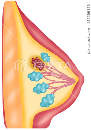 Breast Cancer, Hand-drawn Watercolor Illustration 132306156
