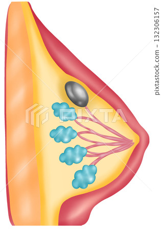 Breast Cysts, Hand-drawn Watercolor Illustration Breast Cysts, Hand-drawn Watercolor Illustration 132306157