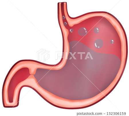 Anatomy of the Stomach in Acid Reflux, GERD 132306159