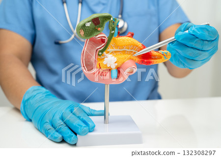 Pancreatitis, pancreatic cancer, Asian doctor with pancreas, gallbladder and bile duct human anatomy model at hospital. 132308297