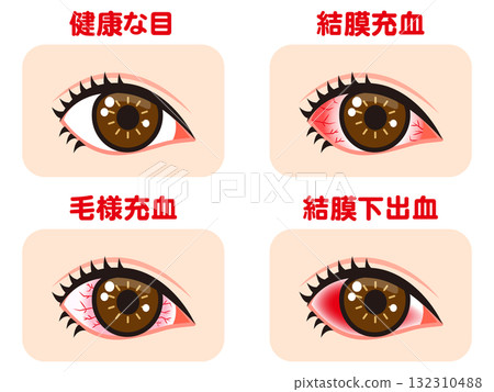 插圖素材集充血的眼睛 插圖素材集充血的眼睛 132310488