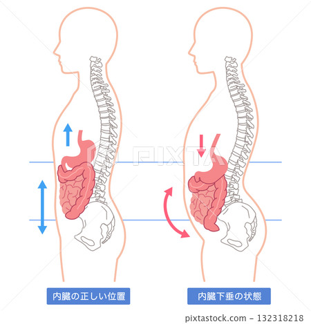 內臟下垂：內臟器官下垂的一種狀況 132318218