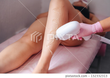 Specialist performing laser hair removal procedure in beauty salon 132332313