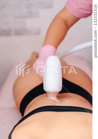 Specialist performing laser hair removal procedure in beauty salon 132332316