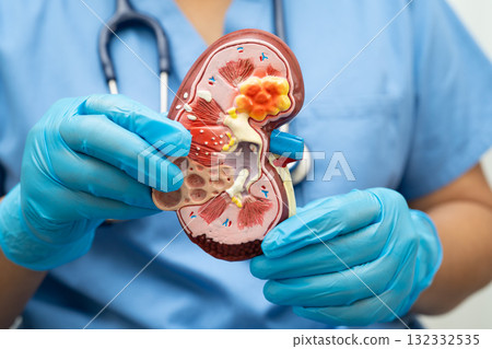 Chronic kidney disease, doctor with model for treatment urinary system, urology, Estimated glomerular filtration rate eGFR. Chronic kidney disease, doctor with model for treatment urinary system, urology, Estimated glomerular filtration rate eGFR. 132332535