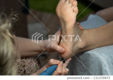 Electric pedicure device for peeling feet. Electric pedicure device for peeling feet. 132339872