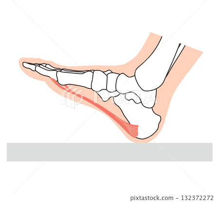 Plantar fasciitis, plantar fascia, plantar aponeurosis, foot muscles 132372272
