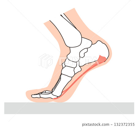 足底筋膜炎、足底筋膜、足底腱膜、足部肌肉 132372355