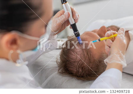 Trichologist doing man improve hair growth procedure, dermapen microneedling, vitamin injections Trichologist doing man improve hair growth procedure, dermapen microneedling, vitamin injections 132409728