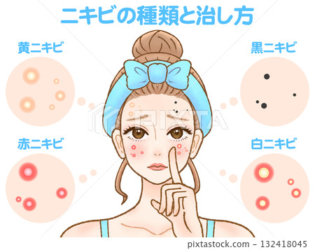 患有成人痤瘡和皮膚粗糙的成年女性的插圖材料3 132418045