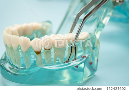 Dental teeth model with dentist tool for dentistry. Dental teeth model with dentist tool for dentistry. 132425602