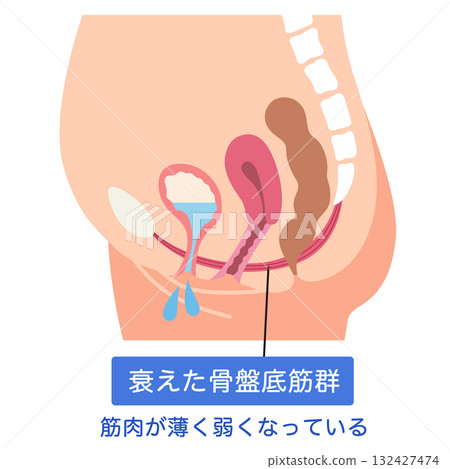 骨盆底肌肉無力 骨盆底肌肉 骨盆底肌肉無力 骨盆底肌肉 132427474