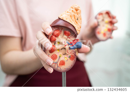 Chronic kidney disease, Asian woman with model for treatment urinary system, urology, Estimated glomerular filtration rate eGFR. Chronic kidney disease, Asian woman with model for treatment urinary system, urology, Estimated glomerular filtration rate eGFR. 132434605