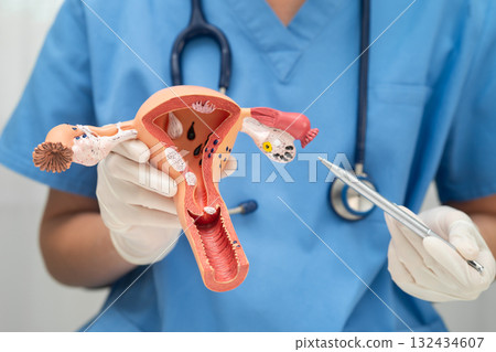 Uterus, doctor holding human anatomy model for study diagnosis and treatment in hospital. 132434607