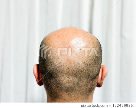 一位三十多歲、頭髮稀疏的男子 132439986