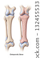 Healthy vs Osteoporotic Bone Microstructure 132455533