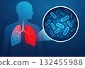 Image illustrates human respiratory system, highlighting lungs red, with close up of bacteria depicted circular inset. This visual emphasizes 132455988