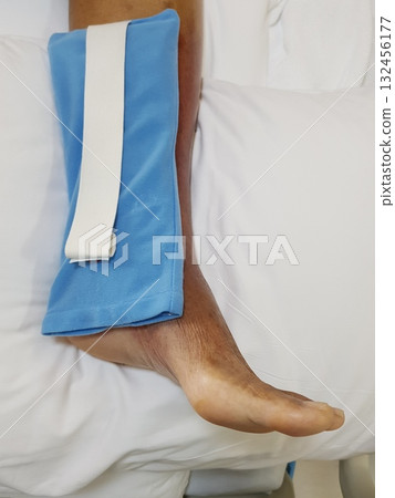 Purpura caused by cancer on leg is side effect of chemotherapy or caused by cancer cells interfering with platelet production in the bone marrow. 132456177