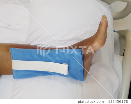 Purpura caused by cancer on leg is side effect of chemotherapy or caused by cancer cells interfering with platelet production in the bone marrow. 132456178