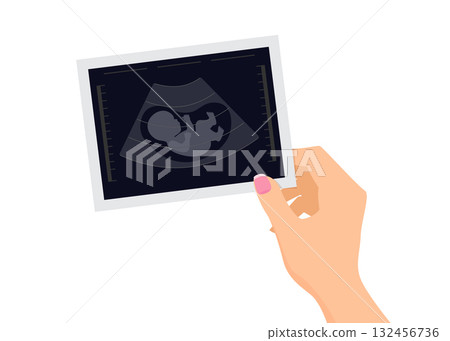 Female hands holding ultrasound image of baby stock illustration. Female hands holding ultrasound image of baby stock illustration. 132456736