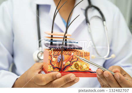 Asian dermatologist doctor holding skin structure model anatomy for treatment in hospital, hair transplant. 132482707