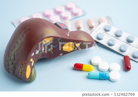 Liver model with pill drug treatment, Cirrhosis, Liver cancer, fatty liver. 132482709