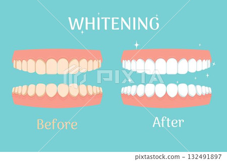Whitening teeths before and after, stomatology, dental concept isolated. Healthcare and beauty stock Whitening teeths before and after, stomatology, dental concept isolated. Healthcare and beauty stock 132491897