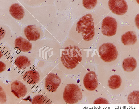 Observation of prophase of somatic cell division 132492592