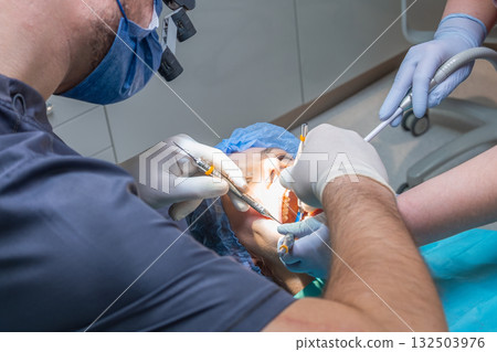 Professional works with suture in woman open mouth during surgical procedure. Retractors and forceps used to facilitate precise manipulation. High quality photo 132503976