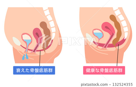 骨盆底肌肉衰弱和健康 132524355