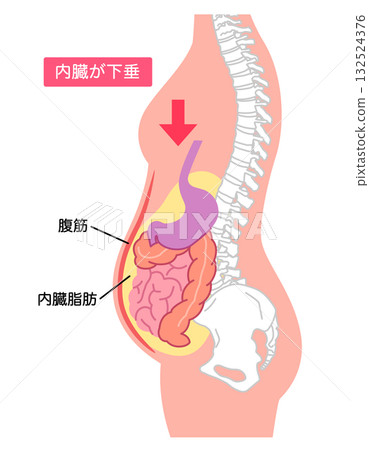 Visceroptosis: A condition in which the internal organs are lowered 132524376
