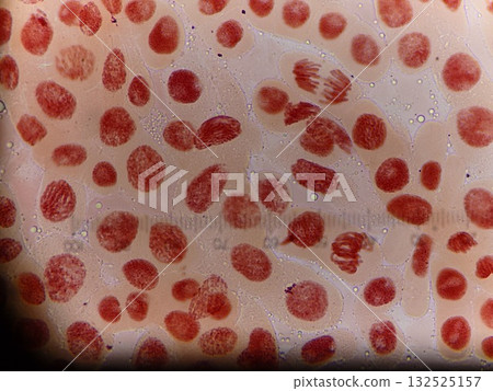 Somatic cell division in the root tip of an onion 132525157
