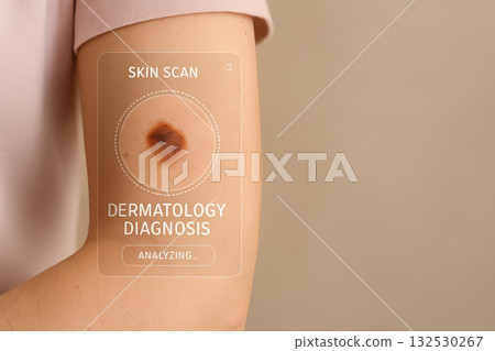 Medical skin scan showing dermatology diagnosis analyzing mole on arm for health checkup and early detection of skin disease in medical examination Medical skin scan showing dermatology diagnosis analyzing mole on arm for health checkup and early detection of skin disease in medical examination 132530267