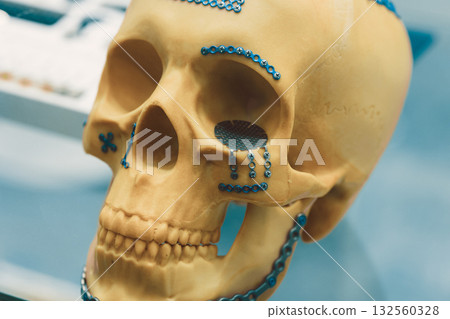 Metal Implants for Facial Surgery repair part, Medical titanium alloys for secure fractured bones 132560328