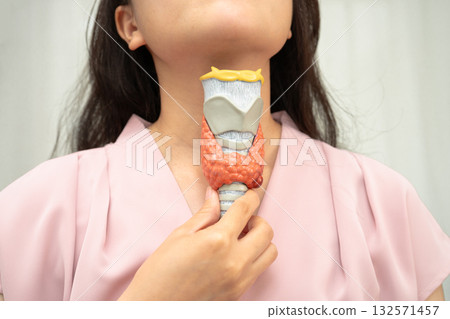 Hyperthyroidism, Overactive Thyroid, Thyroid Lymphoma, Asian woman with thyroid gland human anatomy model. Hyperthyroidism, Overactive Thyroid, Thyroid Lymphoma, Asian woman with thyroid gland human anatomy model. 132571457
