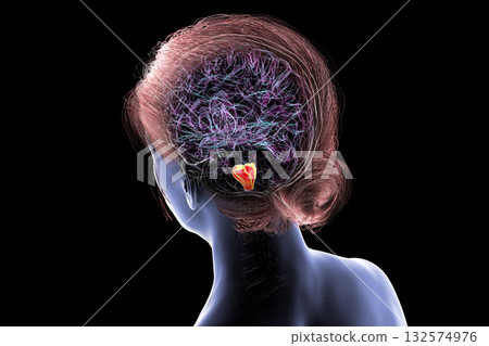 Medulla oblongata highlighted in human brain, 3D illustration 132574976