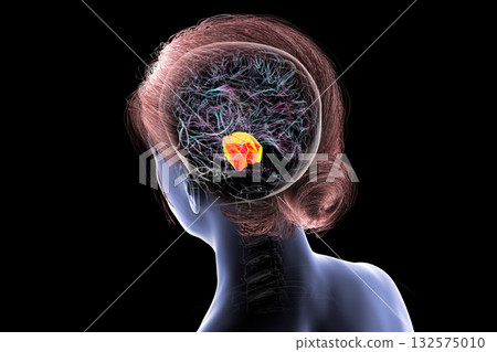 Pons highlighted in human brain, 3D illustration. Pons highlighted in human brain, 3D illustration. 132575010