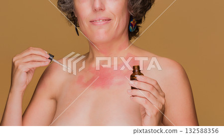 Woman applying serum to sensitive skin with redness Woman applying serum to sensitive skin with redness 132588356