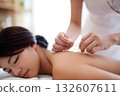 A woman relaxing with acupuncture treatment. Beauty and health care for improving stiff shoulders 132607611