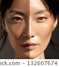 Before and after comparison of skin. A woman who improved her skin with blemish, pore, and anti-aging care. 132607674