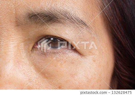 Senior woman eye strain after for long stretches at digital screens. Senior woman eye strain after for long stretches at digital screens. 132628475