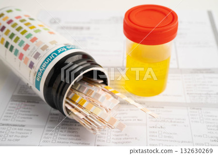 Urinalysis, urine cup with reagent strip pH paper test and comparison chart in laboratory. Urinalysis, urine cup with reagent strip pH paper test and comparison chart in laboratory. 132630269