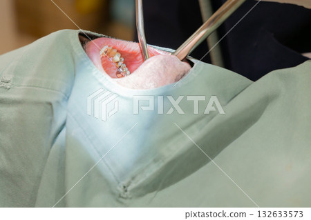 Medical dentist treatment image 132633573