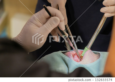 Medical dentist treatment image 132633574