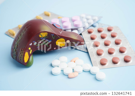 Liver model with pill drug treatment, Cirrhosis, Liver cancer, fatty liver. 132641741