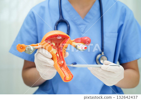 Uterus, doctor holding human anatomy model for study diagnosis and treatment in hospital. Uterus, doctor holding human anatomy model for study diagnosis and treatment in hospital. 132642437